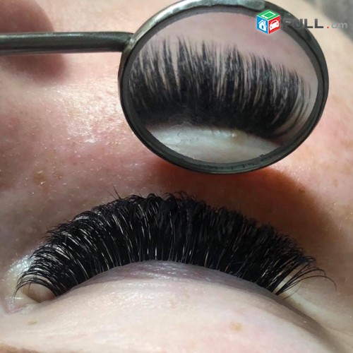 tartichneri licqi profesional daser